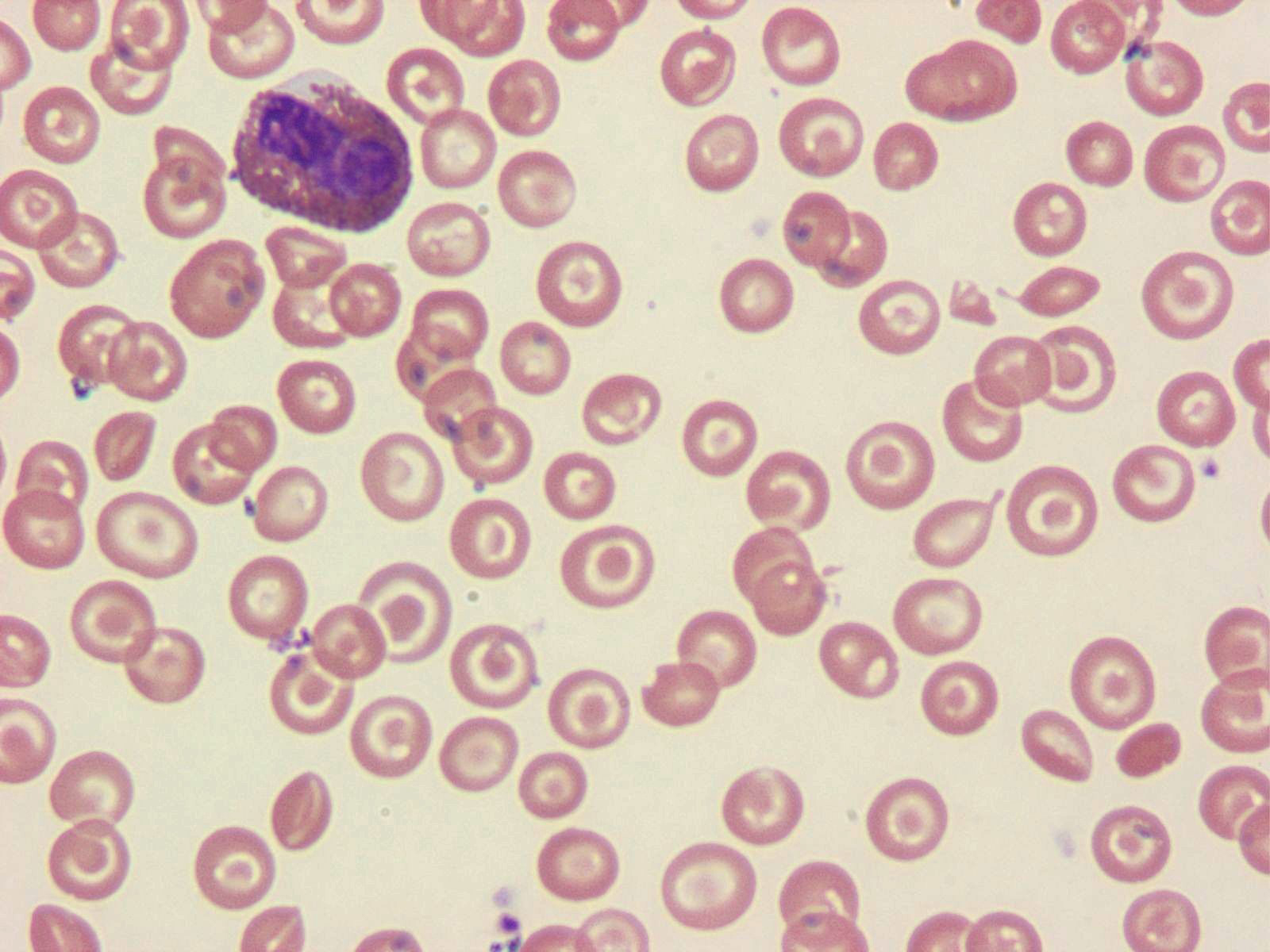 Red blood cells - Free healthcare and medical icons